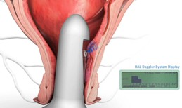 HAL sound